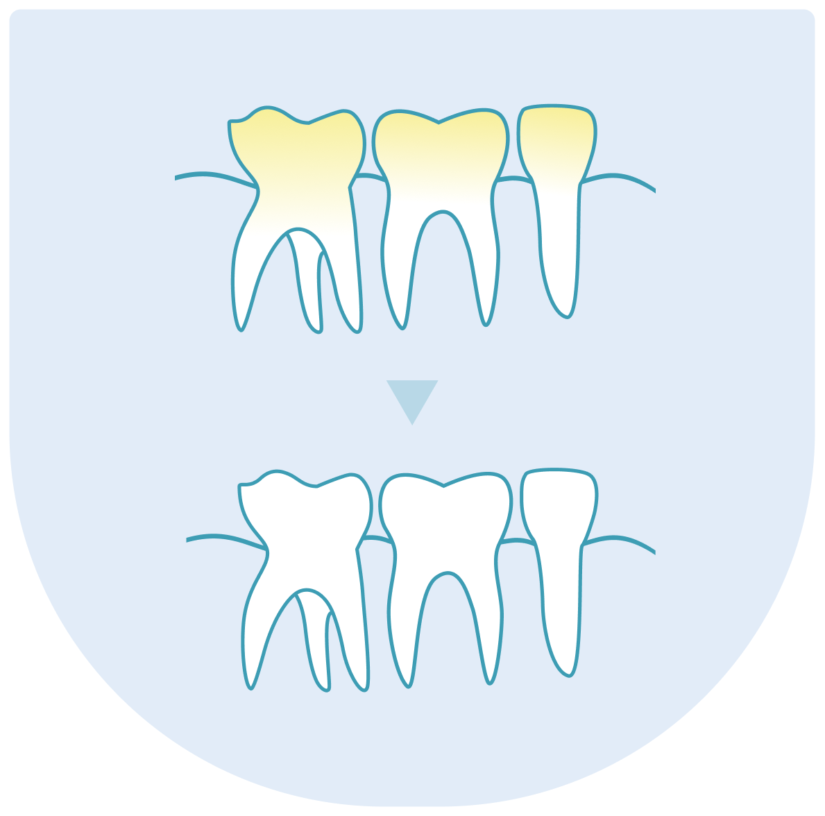 Bělení zubů v Praze
