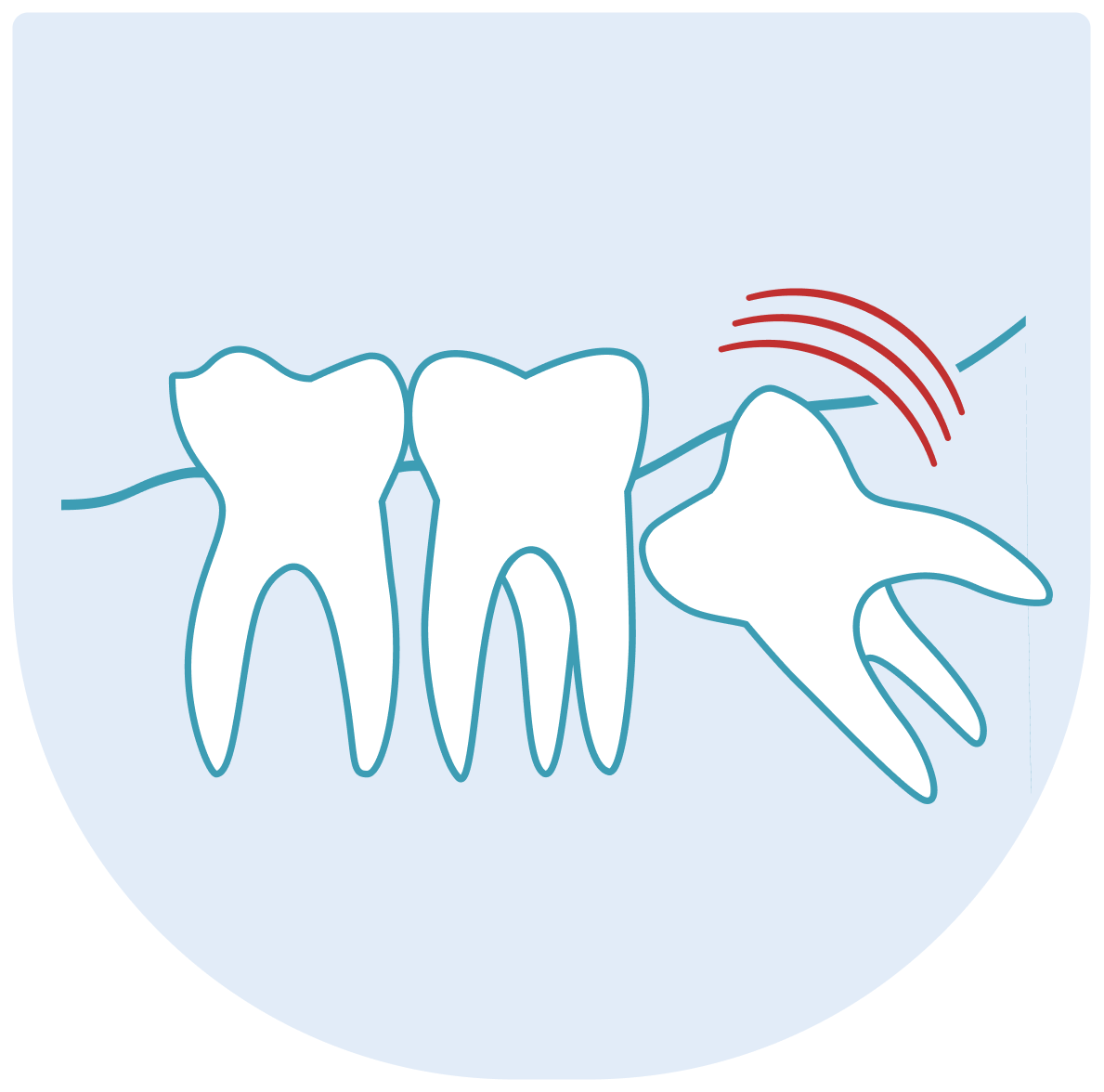 Stomatochirurgie a extrakce zubů v Praze