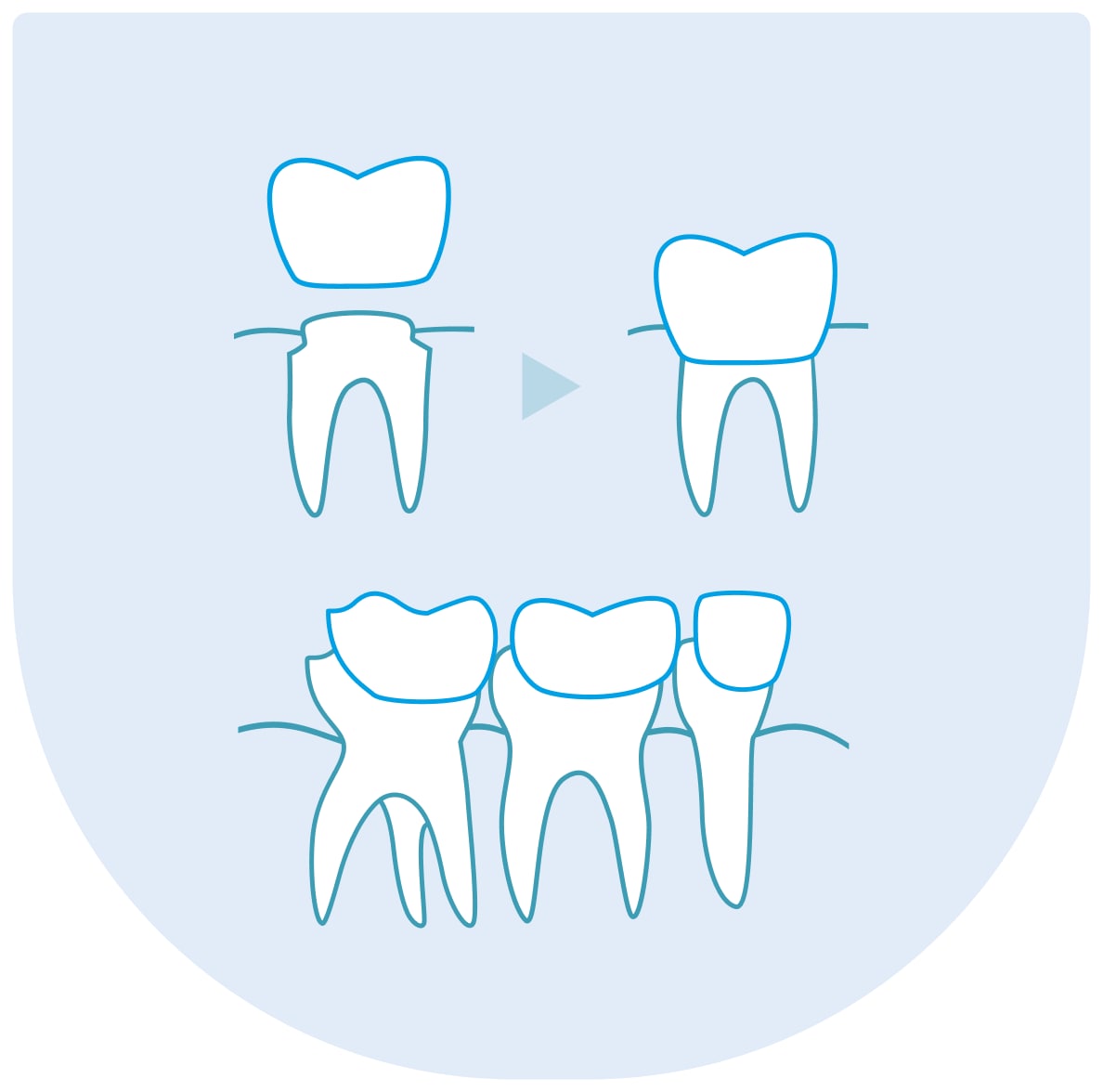 Zubní protetika v Praze
