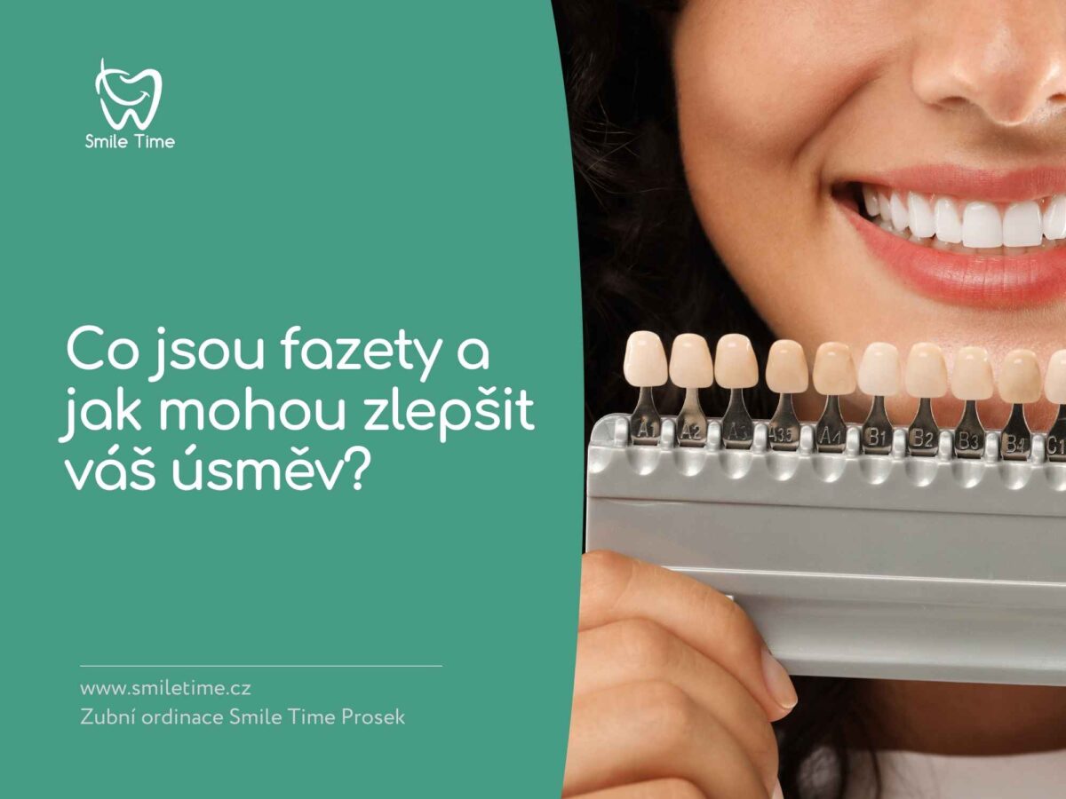 zubní fazety